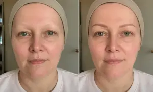 Przed i po: odzyskanie naturalnego wyglądu brwi po chemioterapii. Kobieta z delikatnie zaznaczonymi brwiami.