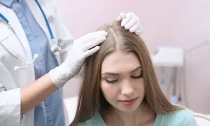 Lekarz od włosów bada skórę głowy pacjentki.