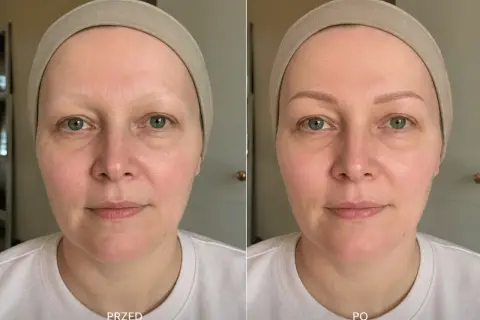 Przed i po: odzyskanie naturalnego wyglądu brwi po chemioterapii. Kobieta z delikatnie zaznaczonymi brwiami.