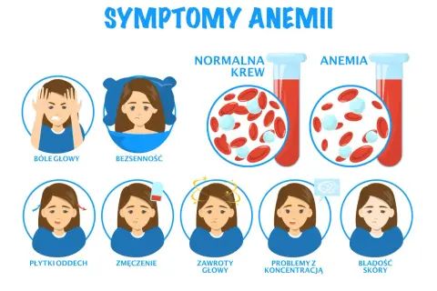 Objawy anemii, w tym niedobór żelaza, mogą objawiać się bólami głowy, bezsennością, zmęczeniem, zawrotami głowy, problemami z koncentracją i bladością skóry.