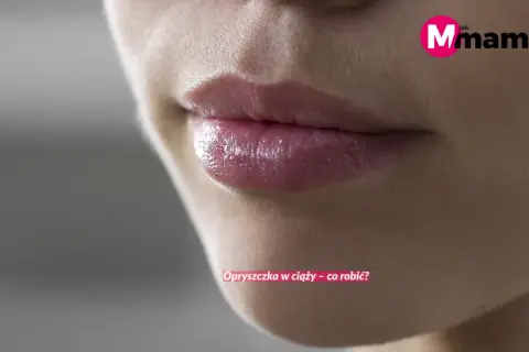 Zbliżenie na usta kobiety z widoczną opryszczką. Tekst informuje o przyczynach opryszczki na ustach i sposobach radzenia sobie z nią w ciąży.