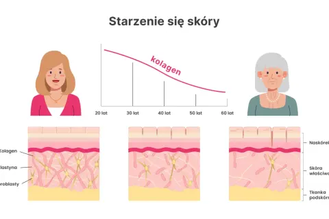 Spadek kolagenu z wiekiem powoduje widoczne objawy starzenia się skóry, takie jak zmarszczki. Ilustracja pokazuje zmiany w strukturze skóry.