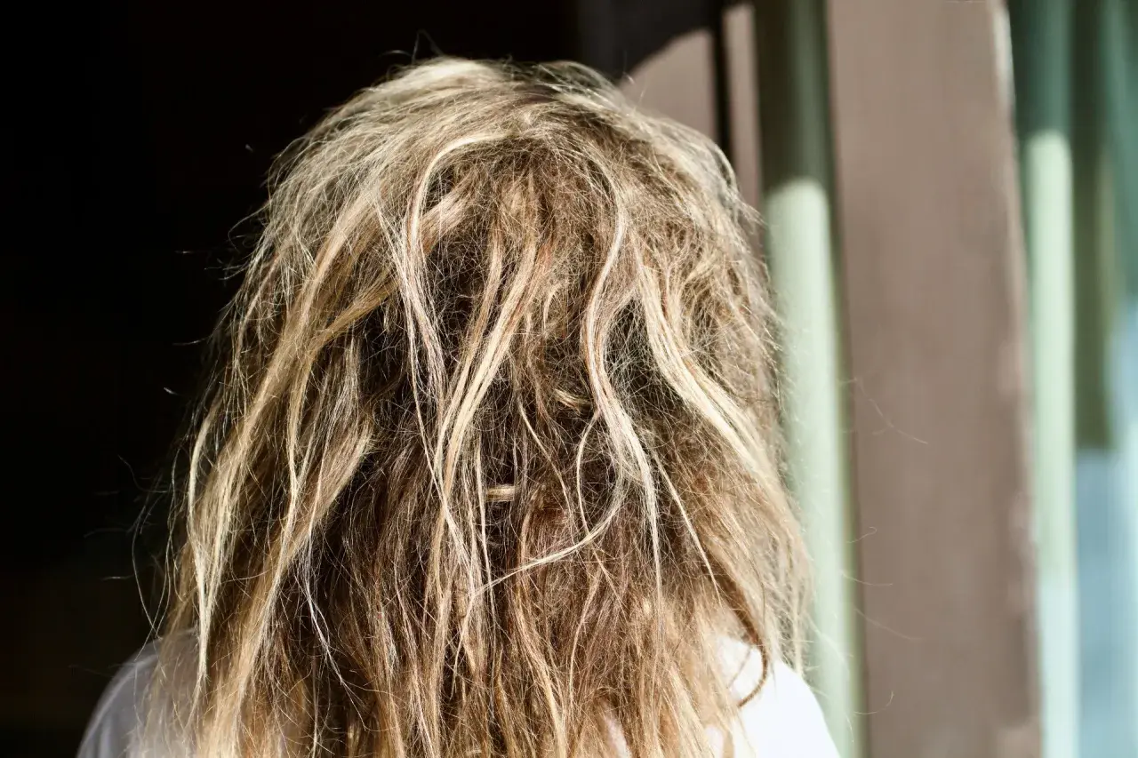Widok z tyłu na blond włosy z widocznymi kołtunami. To nie jest choroba, ale efekt braku pielęgnacji.