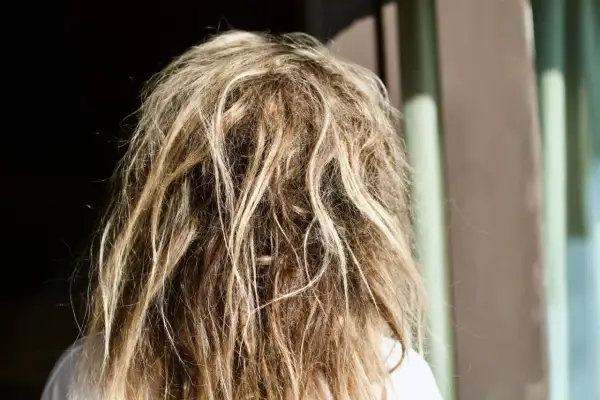 Widok z tyłu na blond włosy z widocznymi kołtunami. To nie jest choroba, ale efekt braku pielęgnacji.